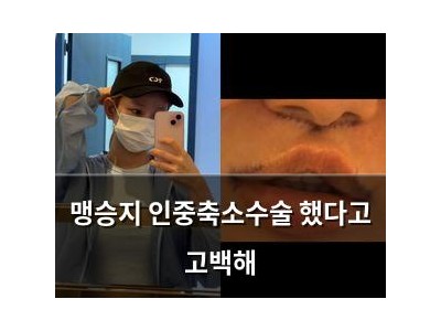 맹승지 인중축소수술 했다고 고백해