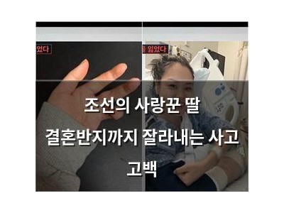 조선의 사랑꾼 딸 결혼반지까지 잘라내는 사고 고백